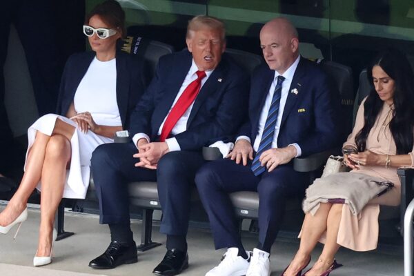 Trump diagnosed with chronic venous insufficiency