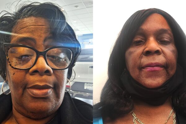 65-year-old furloughed by government shutdown: ‘I could lose everything’