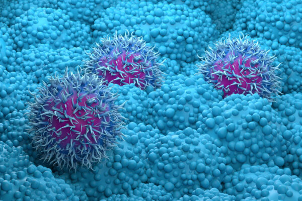 Pancreatic cancer drug daraxonrasib from Revolution Medicines succeeds in trial