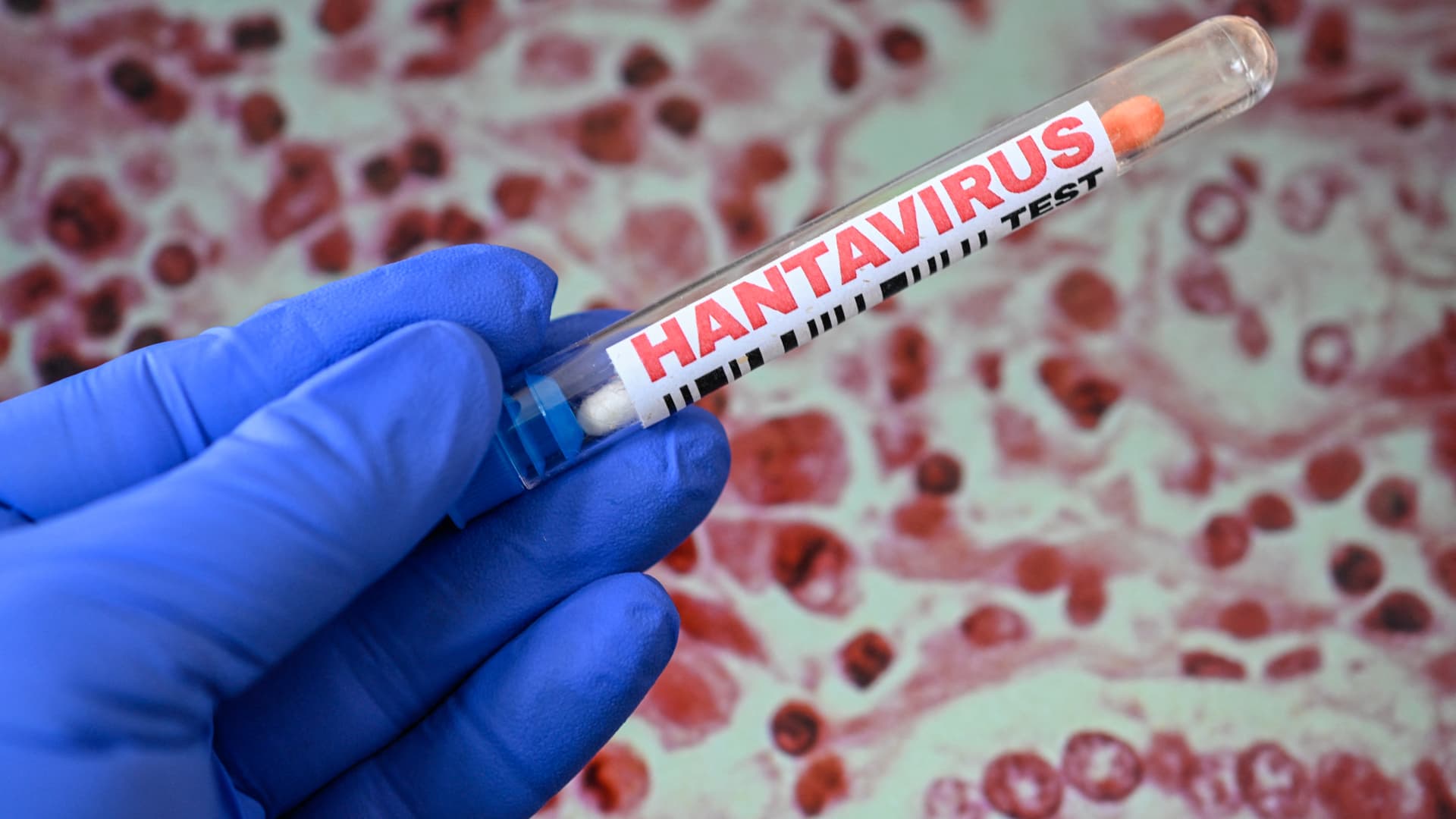 Hantavirus outbreak: Little chance says Kalshi