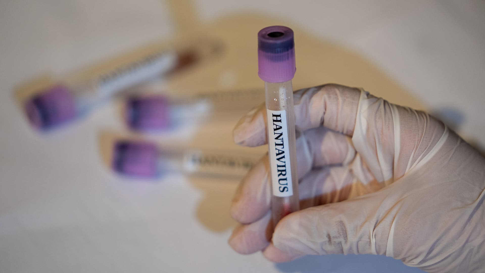 CDC says there are no U.S. hantavirus cases currently, 41 people being monitored